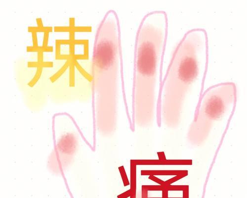 切辣椒辣手了怎么办（学会正确切辣椒）