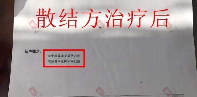 解决热水器进水口青苔问题的方法（清洁维护）