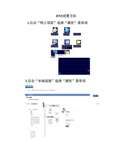 CentOS7如何配置DNS服务？管理DNS有哪些步骤？