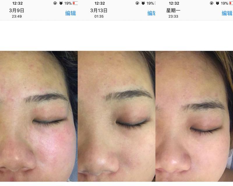 这样修复太容易了？遇到问题如何快速解决？