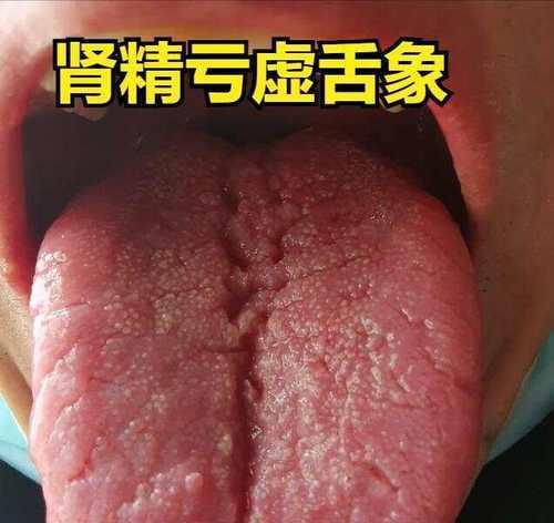 图标大老少皆可用？如何选择适合所有年龄段的图标设计？