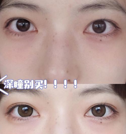 手机如何使用大眼珠子摄像头拍照？拍照技巧有哪些？