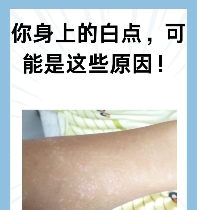 手机拍照出现白点是什么原因？