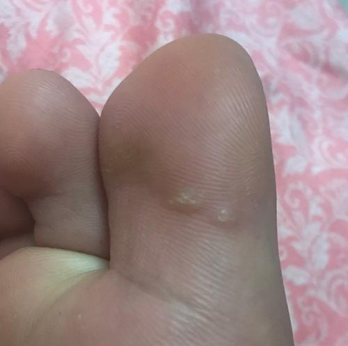手机拍照出现白点是什么原因？